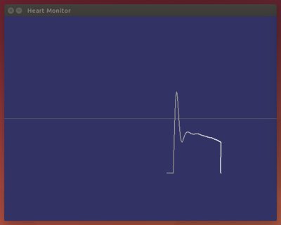 SDL heart monitor